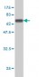 THUMPD1 Antibody (monoclonal) (M01)